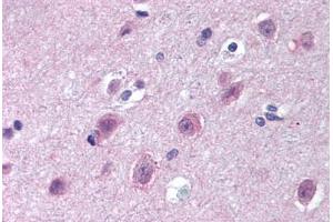 Human Brain, Cortex (formalin-fixed, paraffin-embedded) stained with IPO9 antibody ABIN297232 at 10 ug/ml followed by biotinylated goat anti-rabbit IgG secondary antibody ABIN481713, alkaline phosphatase-streptavidin and chromogen. (Importin 9 Antikörper  (AA 950-1000))