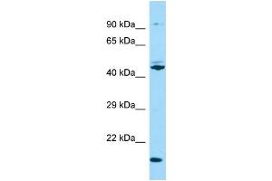 Western Blotting (WB) image for anti-Outer Dense Fiber of Sperm Tails 3 (ODF3) (N-Term) antibody (ABIN2790487) (ODF3 Antikörper  (N-Term))
