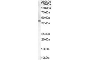 Western Blotting (WB) image for anti-ATPase, H+ Transporting, Lysosomal 13kDa, V1 Subunit G3 (ATP6V1G3) (Middle Region) antibody (ABIN2789194)