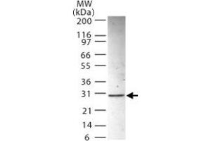 Western blot analysis of ANP32B in HL-60 whole cell lysate using ANP32B polyclonal antibody  at 2 ug/mL . (ANP32B Antikörper  (AA 1-17))