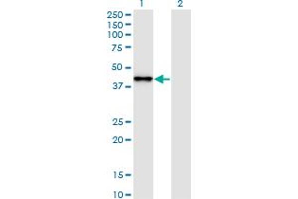 SNAPC2 Antikörper  (AA 16-114)
