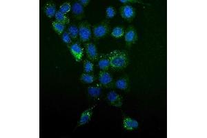 anti-Mitogen-Activated Protein Kinase Kinase Kinase Kinase 5 (MAP4K5) (N-Term) antibody