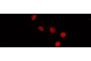ABIN6272431 staining MCF7 by IF/ICC. (SIN3B Antikörper  (Internal Region))