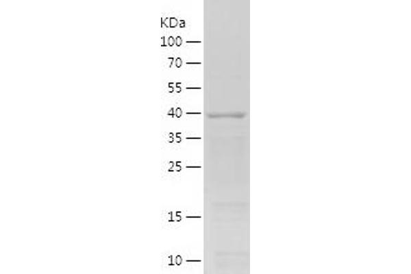 Cyclin A Protein (AA 268-432) (His-IF2DI Tag)