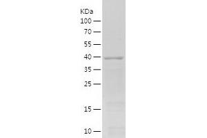 Western Blotting (WB) image for Cyclin A2 (CCNA2) (AA 268-432) protein (His-IF2DI Tag) (ABIN7122518) (Cyclin A Protein (AA 268-432) (His-IF2DI Tag))