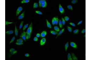 Immunofluorescence (IF) image for anti-Aspartate beta-Hydroxylase (ASPH) (AA 75-270) antibody (ABIN7144757)