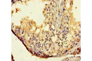 Immunohistochemistry of paraffin-embedded human testis tissue using ABIN7171540 at dilution of 1:100