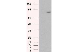 Western Blotting (WB) image for Catenin (Cadherin-Associated Protein), alpha 1, 102kDa (CTNNA1) peptide (ABIN369355) (Catenin (Cadherin-Associated Protein), alpha 1, 102kDa (CTNNA1) Peptid)