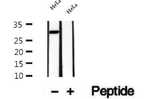 Western blot analysis of extracts of HeLa cells, using CPSF4 antibody.