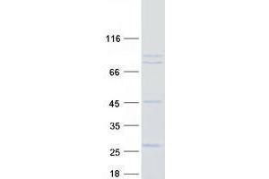 USP44 Protein (Transcript Variant 2) (Myc-DYKDDDDK Tag)