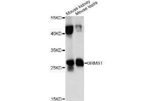 Western blot analysis of extracts of various cell lines, using BRMS1 antibody (ABIN6290118) at 1:1000 dilution. (BRMS1 Antikörper)