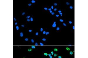 Immunofluorescence analysis of HeLa cells using IRF5 Polyclonal Antibody (IRF5 Antikörper)