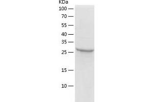 Western Blotting (WB) image for Zinc Finger Protein 518A (ZNF518A) (AA 495-780) protein (His tag) (ABIN7125794)