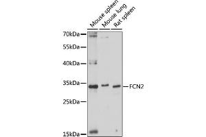 Western blot analysis of extracts of various cell lines, using FCN2 antibody (ABIN7267201) at 1:1000 dilution. (Ficolin 2 Antikörper  (AA 230-290))