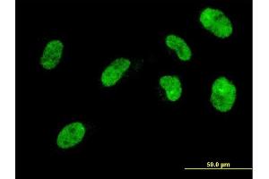 Immunofluorescence of monoclonal antibody to NHLH2 on HeLa cell. (NHLH2 Antikörper  (AA 36-135))