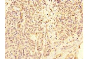 Immunohistochemistry (IHC) image for anti-Fc Fragment of IgG, Low Affinity IIc, Receptor For (CD32) (FCGR2C) (AA 43-223) antibody (ABIN7158545)