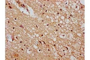 IHC image of ABIN7150197 diluted at 1:400 and staining in paraffin-embedded human brain tissue performed on a Leica BondTM system. (DMAP1 Antikörper  (AA 250-300))