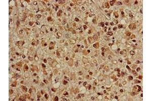 Immunohistochemistry (IHC) image for anti-Heat Shock 70kDa Protein 8 (HSPA8) (AA 418-597) antibody (ABIN7154885)