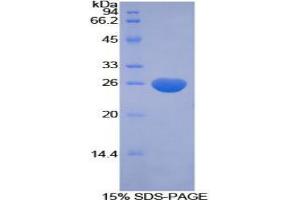 SDS-PAGE analysis of Human CFC1 Protein. (CFC1 Protein)