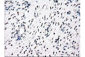 Immunohistochemical staining of paraffin-embedded Ovary tissue using anti-NRBP1mouse monoclonal antibody. (NRBP1 Antikörper)