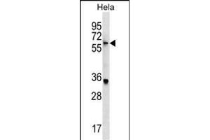 KLH22 Antibody (C-term) (ABIN1537487 and ABIN2849661) western blot analysis in Hela cell line lysates (35 μg/lane).