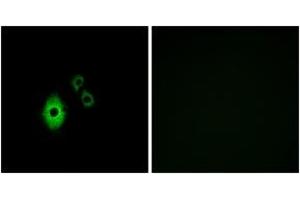 Immunofluorescence analysis of A549 cells, using KCNJ5 Antibody. (KCNJ5 Antikörper  (AA 370-419))