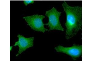 ICC/IF analysis of SBDS in HeLa cells line, stained with DAPI (Blue) for nucleus staining and monoclonal anti-human SBDS antibody (1:100) with goat anti-mouse IgG-Alexa fluor 488 conjugate (Green). (SBDS Antikörper  (AA 1-250))
