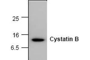 Western Blotting (WB) image for anti-Cystatin B (Stefin B) (CSTB) antibody (ABIN126940) (CSTB Antikörper)