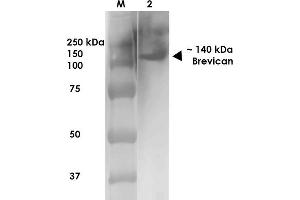 Western Blot analysis of Rat Brain Membrane showing detection of ~140 kDa Brevican protein using Mouse Anti-Brevican Monoclonal Antibody, Clone S294A-6 . (BCAN Antikörper  (AA 219-655) (PE))