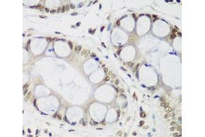 Immunohistochemistry of paraffin-embedded Human gastric using CBX3 Polyclonal Antibody at dilution of 1:200 (40x lens). (CBX3 Antikörper)