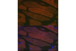 Immunofluorescence analysis of mouse bone marrow cells using SERC/ Rabbit mAb (9639) at dilution of 1:100 (40x lens). (ATP2A1/SERCA1 Antikörper)