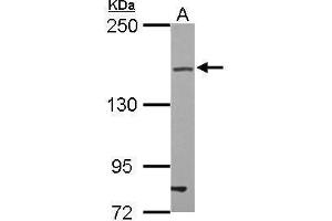 WB Image Sample (30 ug of whole cell lysate) A: U87-MG 5% SDS PAGE antibody diluted at 1:500