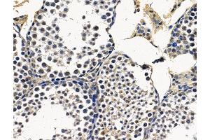 ABIN7096383 and ABIN7100447 at 1/100 staining mouse testis tissue by IHC-P. (MIR22HG Antikörper)
