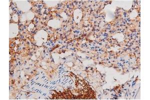 ABIN6267487 at 1/200 staining Mouse lung tissue sections by IHC-P. (alpha Adducin Antikörper  (pSer726))