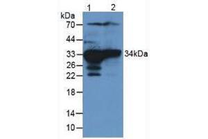 Western blot analysis of (1) Rat Liver Tissue and (2) Rat Kidney Tissue. (SULT1A1 Antikörper  (AA 3-291))