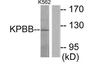 Western Blotting (WB) image for anti-Phosphorylase Kinase, beta (PHKB) (Internal Region) antibody (ABIN1849876) (PHKB Antikörper  (Internal Region))