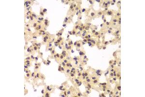 Immunohistochemistry of paraffin-embedded rat lung using CSNK2A2 antibody (ABIN6290214) at dilution of 1:100 (40x lens). (CSNK2A2 Antikörper)
