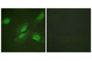 Immunofluorescence analysis of HeLa cells, using Akt (Ab-326) antibody. (AKT1 Antikörper  (Tyr326))