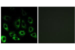 Immunofluorescence analysis of A549 cells, using MBTPS2 antibody. (MBTPS2 Antikörper  (Internal Region))