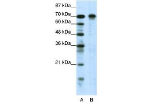 Human Jurkat; WB Suggested Anti-HIC1 Antibody Titration: 0. (HIC1 Antikörper  (N-Term))