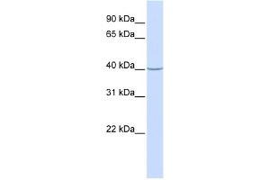 WB Suggested Anti-ACADS Antibody Titration: 0. (ACADS Antikörper  (N-Term))