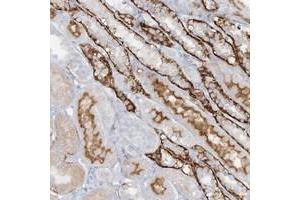 Immunohistochemical staining of human kidney with ATP11A polyclonal antibody  shows strong cytoplasmic and membranous positivity in distal tubules. (ATP11A Antikörper)