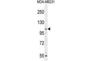 Western blot analysis in MDA-MB231 cell line lysates (35ug/lane) using MYSM1 Antibody (N-term). (MYSM1 Antikörper  (N-Term))