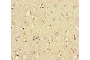 Immunohistochemistry of paraffin-embedded human brain tissue using ABIN7150193 at dilution of 1:100 (LIG3 Antikörper  (AA 809-928))