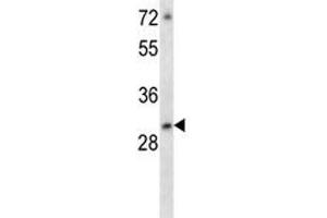 ATF5 antibody western blot analysis in MCF-7 lysate (ATF5 Antikörper  (AA 188-216))