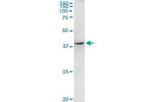 RHOXF2 monoclonal antibody (M07), clone 3C4. (RHOXF2 Antikörper  (AA 1-288))