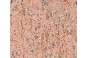 IHC-P analysis of brain tissue, with DAB staining. (INPP4A Antikörper  (AA 1-137))