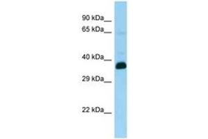 Image no. 1 for anti-Snurportin 1 (SNUPN) (AA 24-73) antibody (ABIN6748330) (Snurportin 1 Antikörper  (AA 24-73))
