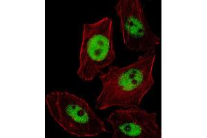 Immunofluorescence (IF) image for anti-Paired-Like Homeobox 2b (PHOX2B) antibody (ABIN2996148) (PHOX2B Antikörper)