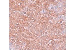 Immunohistochemical staining of mouse liver cells with SLC39A12 polyclonal antibody  at 2. (SLC39A12 Antikörper  (N-Term))